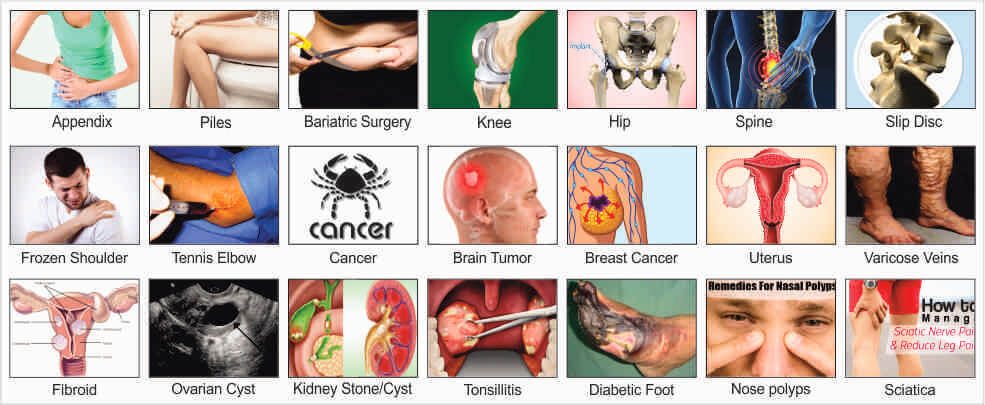 avoid-surgery-through-integropathy